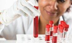 Hemoglobin yüksekliği